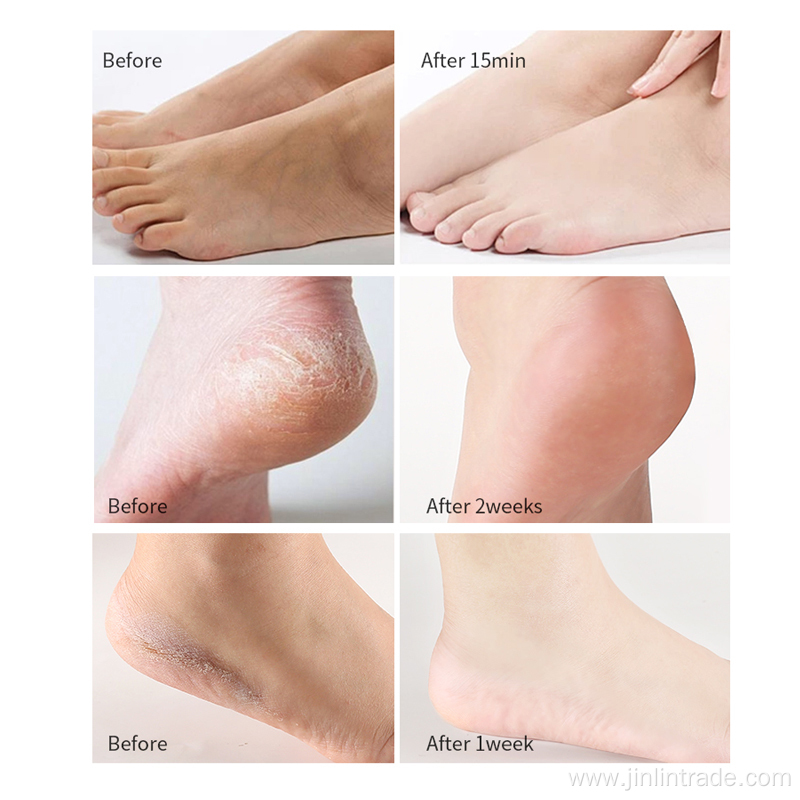 Exfoliation Collagen Peel Off Foot Peel Mask