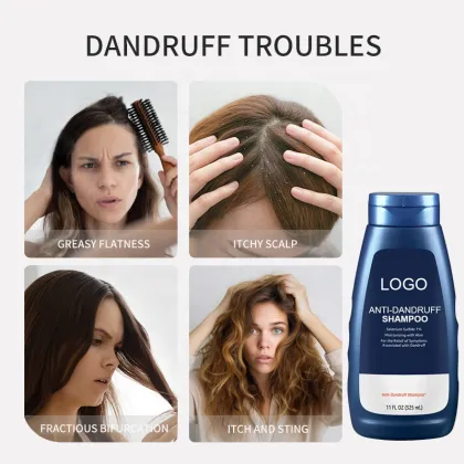Sanrong Factory Herbal Essences Collagen Protein Anti-Itching Anti-Dandruff Shampoo