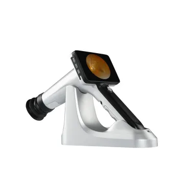 Portable Non-Mydriatic Fundus Camera: 4.7 Inch Color Handheld Retina Camera with 5 Fixation Points