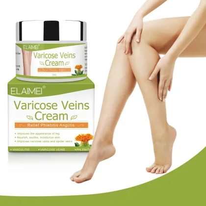 Varicose Veins Cream: Relief for Phlebitis, Vasculitis, and Improved Blood Circulation