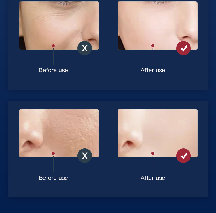 before after red light therapy