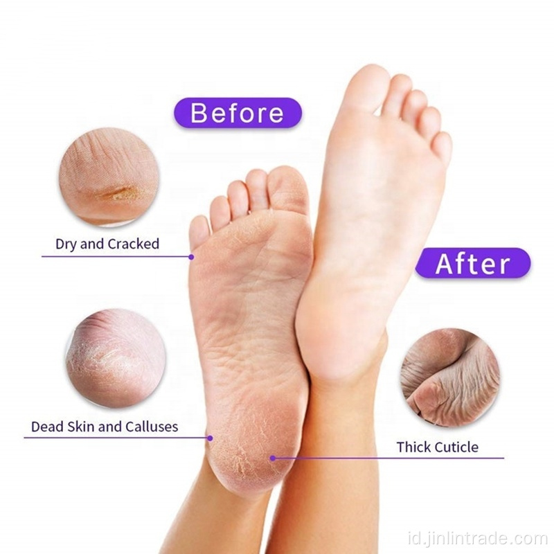 Kulit Mati alami Remover Magic Foot Masker