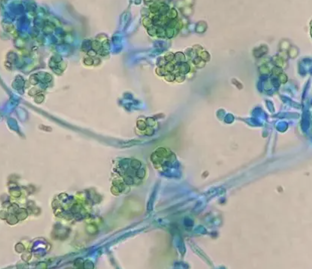 Trichoderma Fermentation Strain