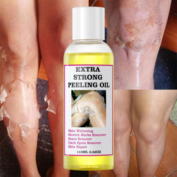 Top Selling Orange Peeling Lotion for Skin Lightening and Dark Spot Removal