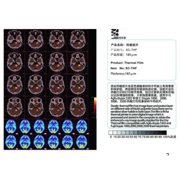 Low Fog Thermal Print Medical Film for Printers