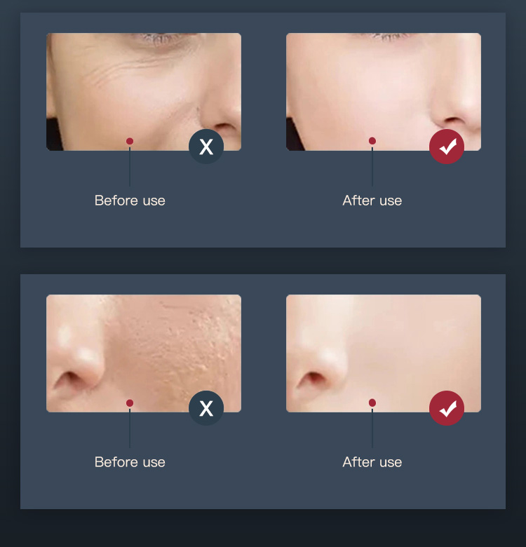 led face light therapy