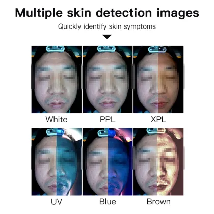Asia AI Technology 3D Face Scanner and Skin Analyzer System