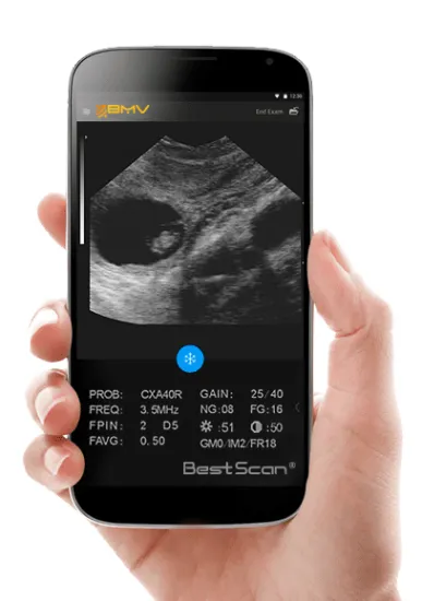 Veterinary Instruments Milk Dairy Farm Ultrasound APP (S3)