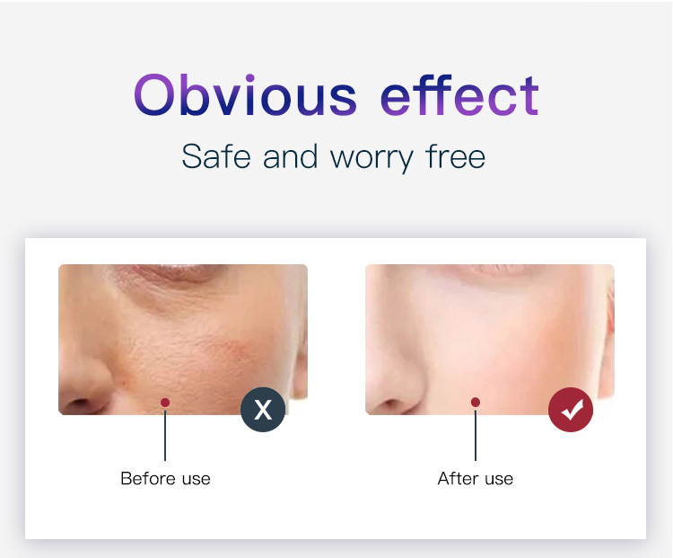 led light treatment for skin