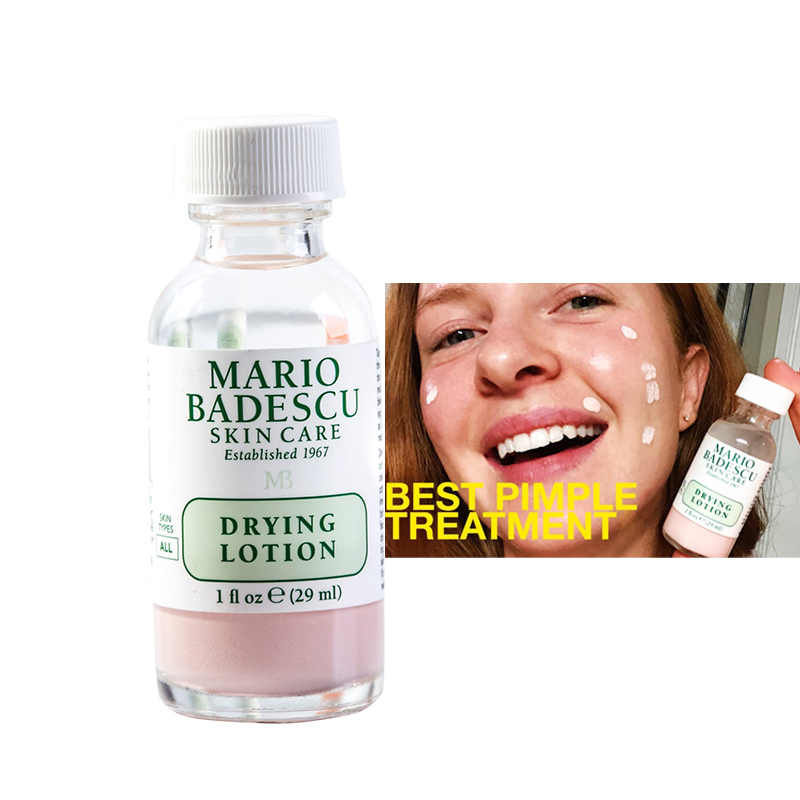 Acne SOS Mario Badescu Drying Lotion 29ml 1oz Effective Acne Spot Treatment