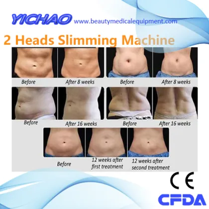 Cavitation Cryolipolysis Weight Loss Fat Body Slimming Equipment