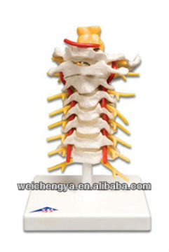 Cervical Vertebral Column with Neck Artery, Occipital, Herniated Disc and Nerves