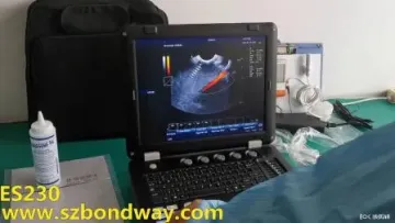 Es230V Veterinary Ultrasound Color Doppler System