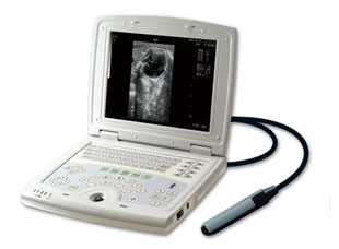Full Digital B Mode Ultrasonic Diagnostic Instruments (SP500)
