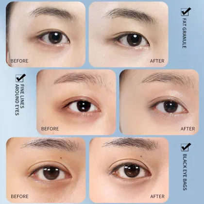 Eye Care Gentle Fades Fine Lines Eye Cream