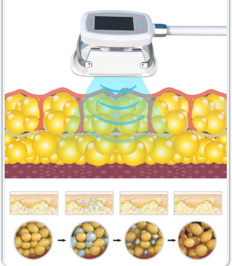 rf machine