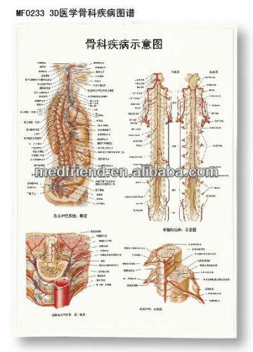 3D Medical Orthopedics Disease Chart