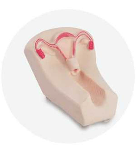 IUD Training Model II