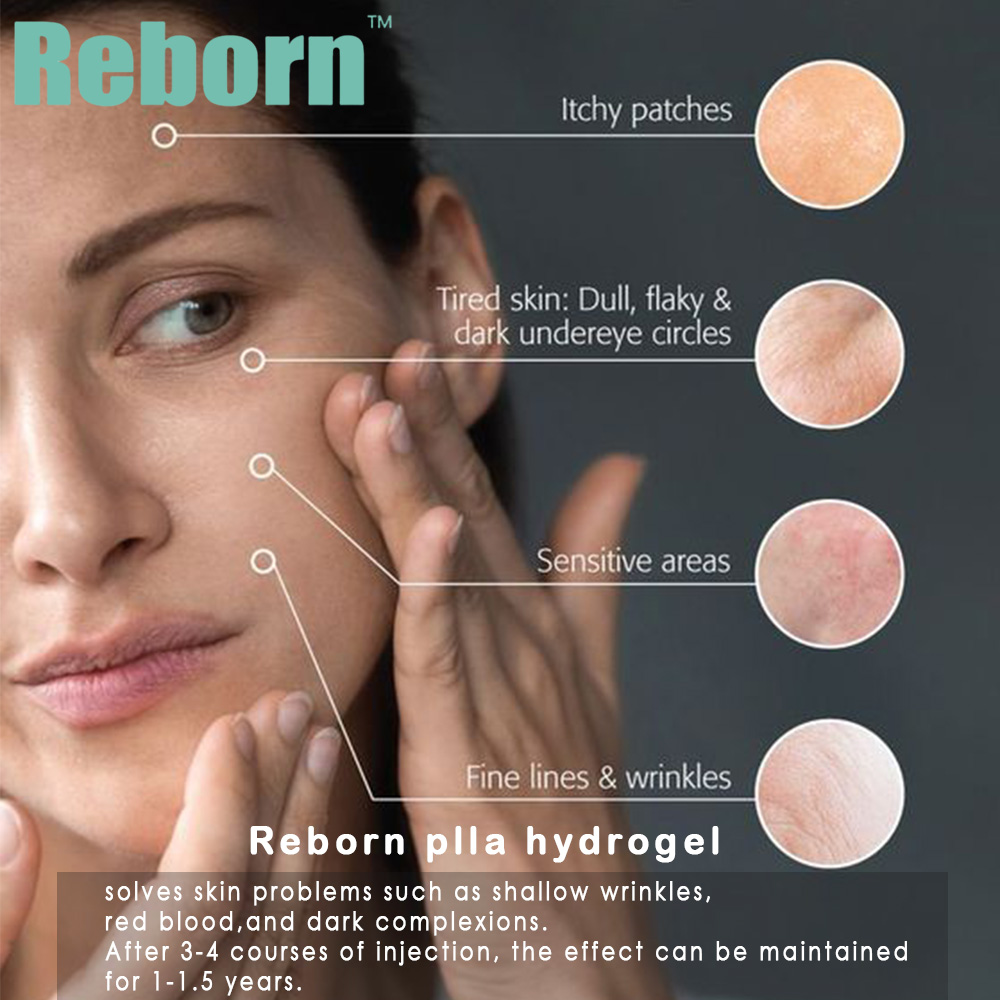 Reborn PLLA Hydrogel แก้ปัญหาผิว Reborn PLLA Hydrogel Solve Skin Problems
