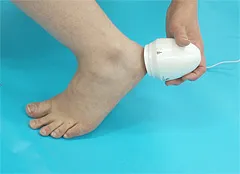 Callus remover