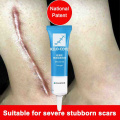 Scar Removal Cream Face Cream Acne Stretch Marks Removal Cream Smooth Skin Natural Renewal Healing Skin Repair Product
