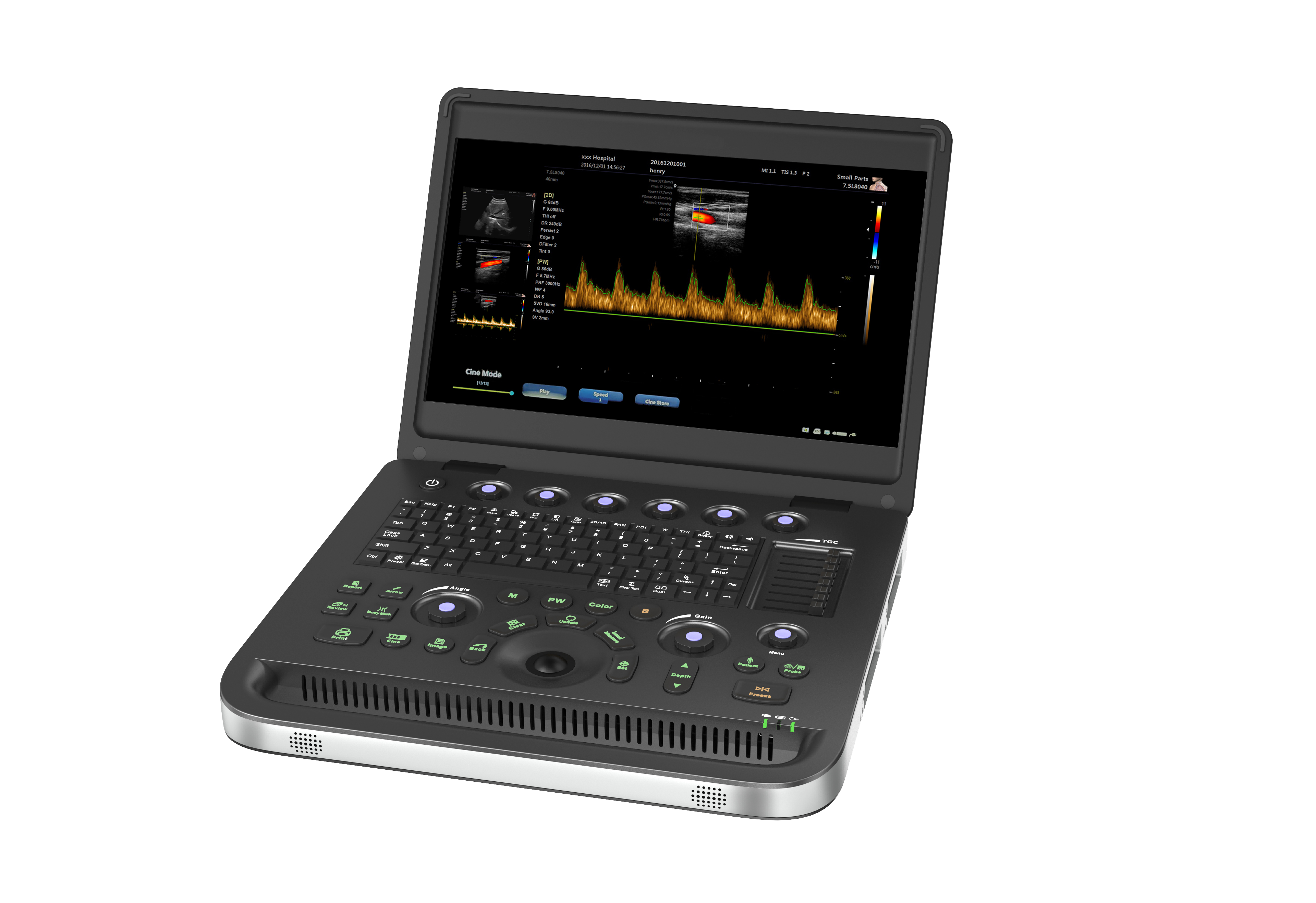 Equipamento de ultrassom Doppler para exame superficial de órgãos