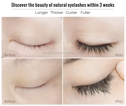 Private Label Eyelash Growth Serum: Chinese Beauty Products for Lash Enhancement