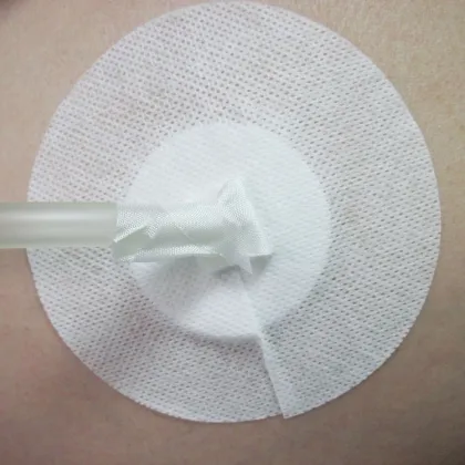 Disposable Abdominal Drainage Tube Holder