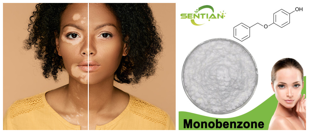 Monobenzone 99% Powder CAS 103-16-2