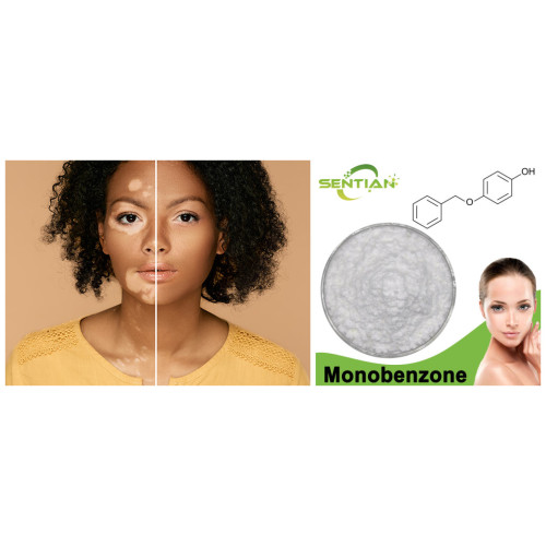 Monobenzone 99% Powder CAS 103-16-2