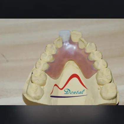 tcs®  Flexible Partial Deture