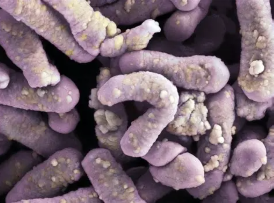 Food Grade Lactobacillus Casei