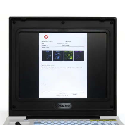 Children gastric ulcer ultrasound diagnostic instrument