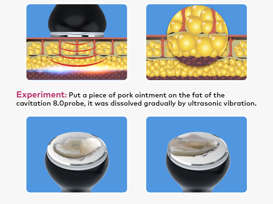 loose skin after weight loss