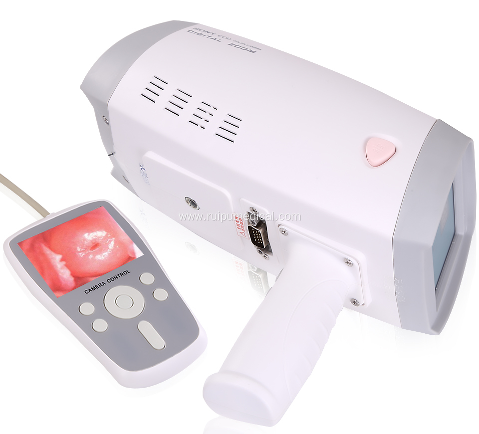 Handheld Digital Full hd Camera for Vagina Colposcope