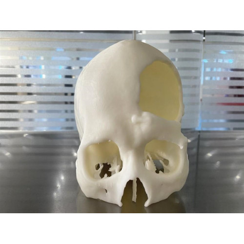 3D -Druck medizinische Teile