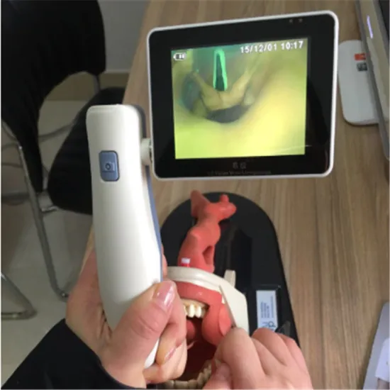New Portable Anesthesia Video Laryngoscope