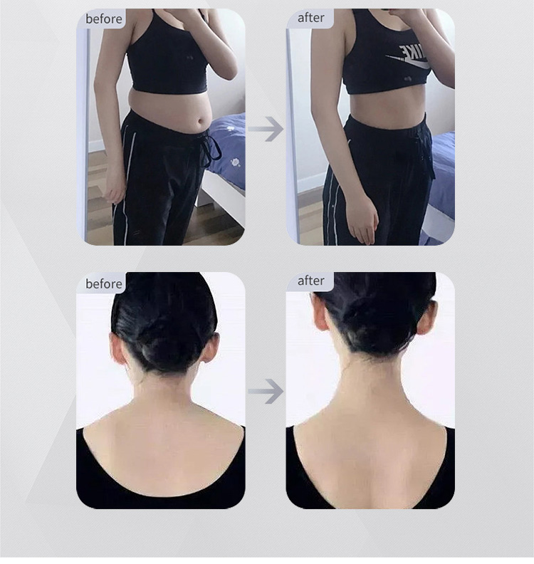 skin tightening treatments