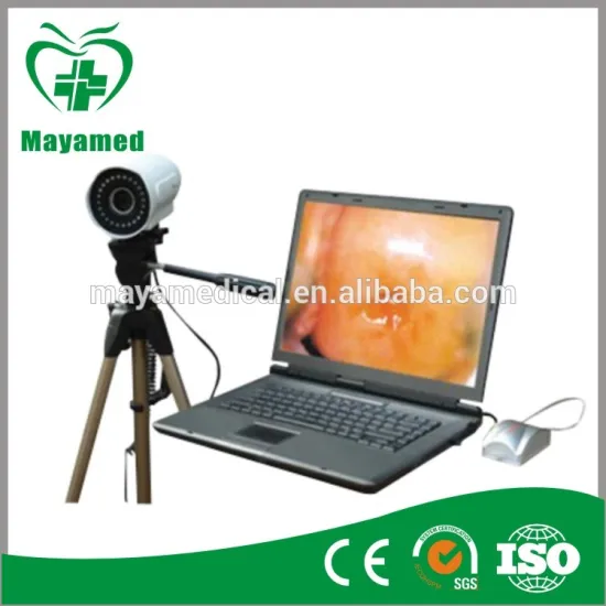 MY-F003 medical equipment gynecology portable Electronic Colposcope price