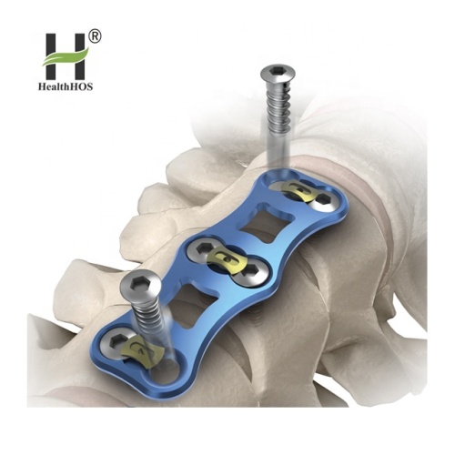 colonna vertebrale ortopedica Placca cervicale anteriore