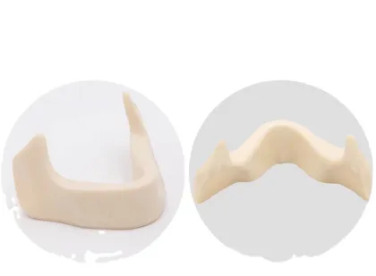 Dental Study Model Clinic Demonstration: Implant Model with Restoration and Implant Bridge