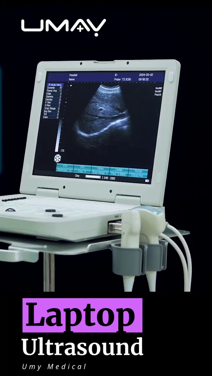 Portable 4D Ultrasound Machine for Veterinary Use
