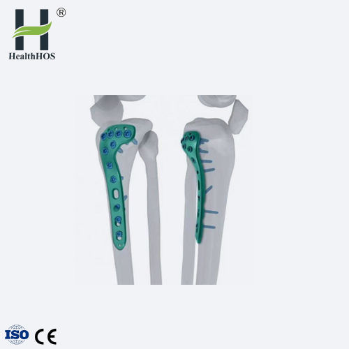 Plat pengunci bentuk T lateral osteotomi proksimal Tibia