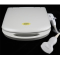 b/w laptop ultrasound machine for pregnancy