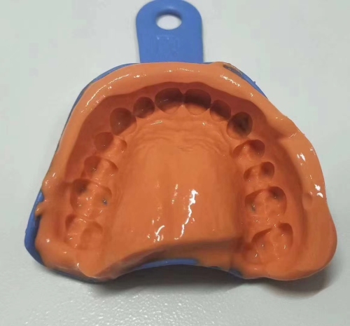 Dental Alginate Impression Materials