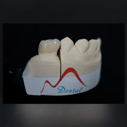 Totally bio compatible  Zirconia Crown