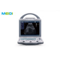 Full Digital B Mode Ultrasound Scanner