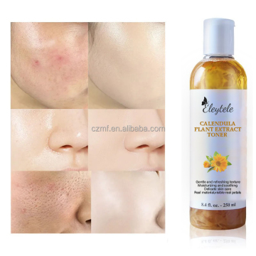 Private Label Organic Calendula Plant Extract Toner