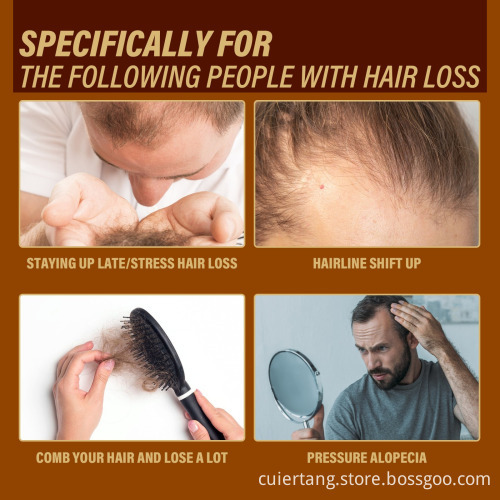 Top Selling Organic Ginger Hair Growth Serum: Your Solution for Strengthened, Repaired Hair Roots
