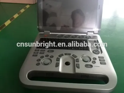 Medical Equipment 3D Color Doppler Ultrasound Diagnosis Machine